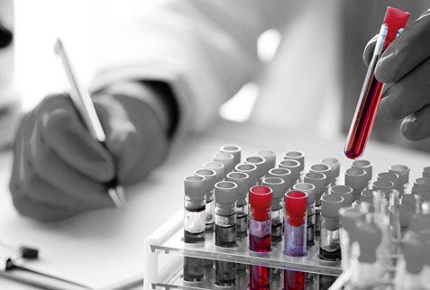 Multi-Cancer Early Detection: Insurance questions amid new evidence