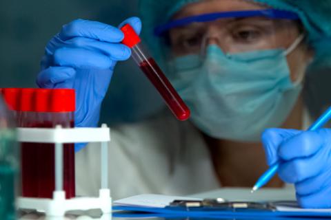 Early-Onset Cancer Is Reshaping Risk: A look into the research. What the progress, plateaus, and pressures mean for insurers?